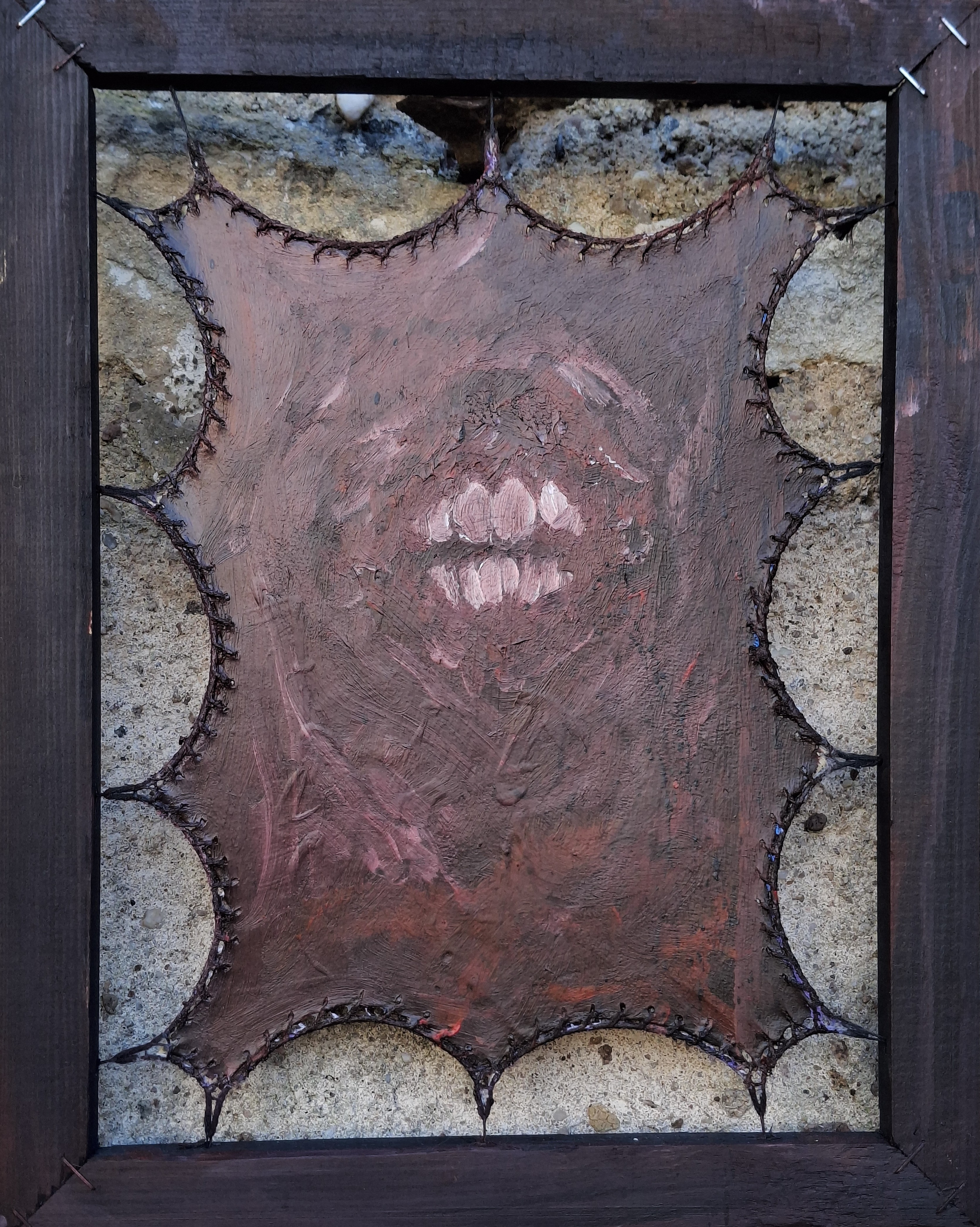 crooked teeth